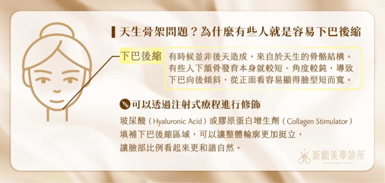 下巴後縮可透過注射是療程改善