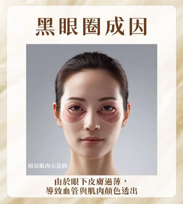 淚溝／黑眼圈成因