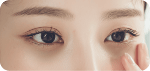 困擾-化妝遮不住