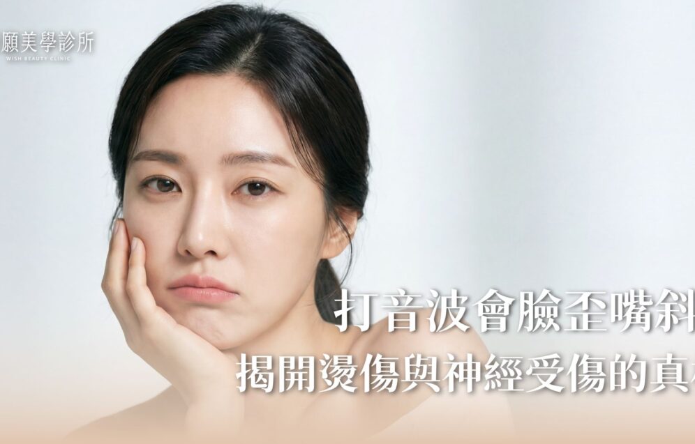 打音波會臉歪嘴斜或燙傷嗎？揭開醫美副作用真相與醫師避險術