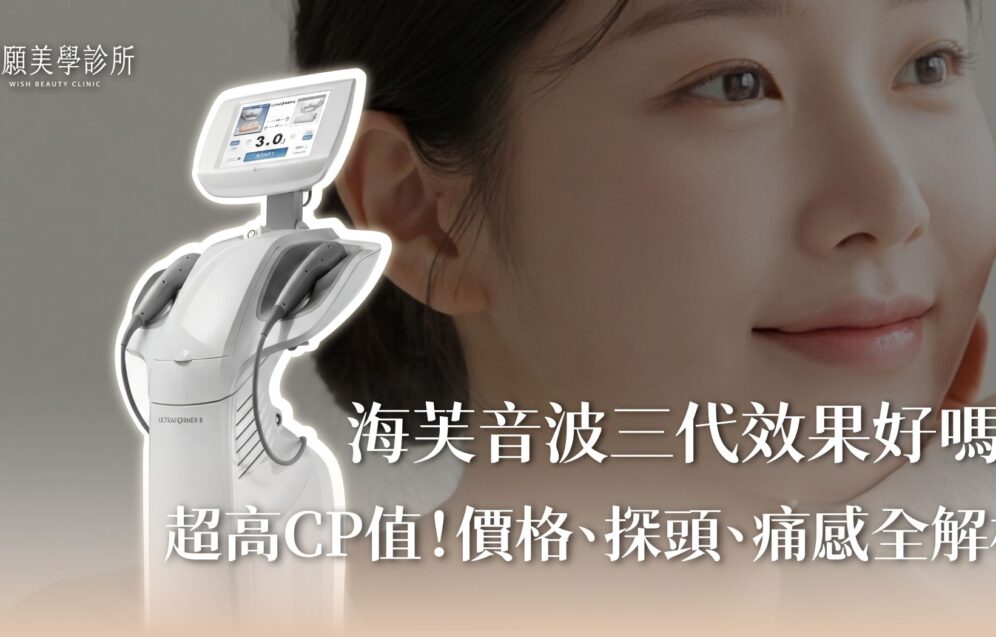 海芙音波第三代效果好嗎？超高CP值！價格、探頭、痛感全解析
