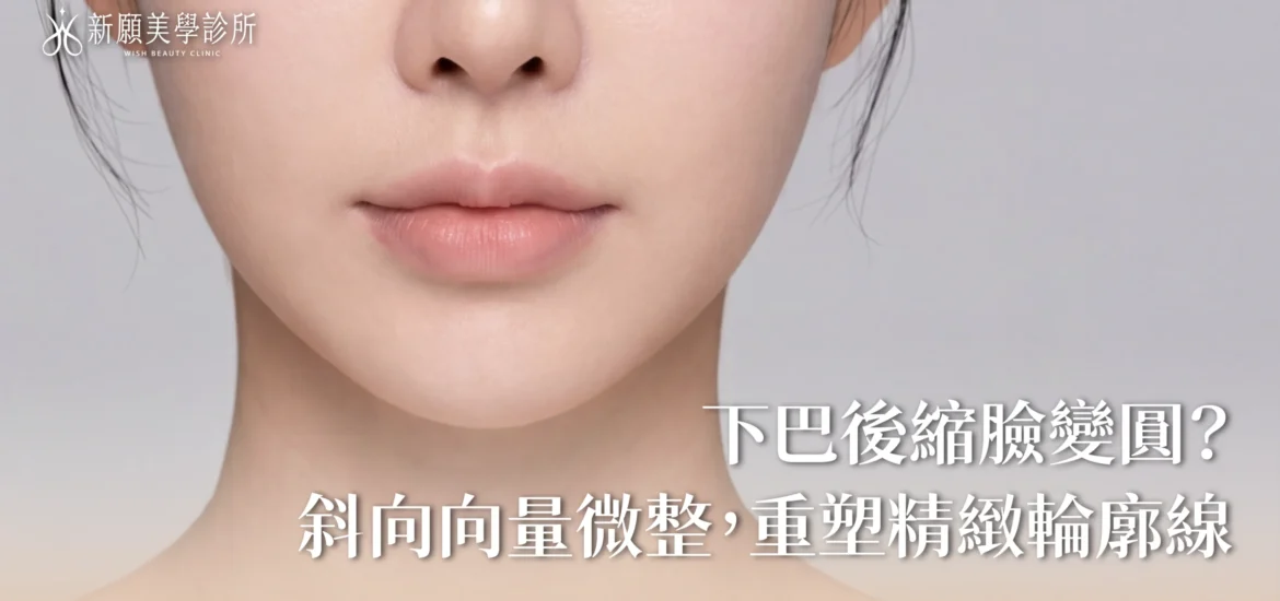 新願美學診所（郭毅昕醫師｜台北醫美推薦｜埋線鼻雕 |台北海芙音波媚必提｜海芙電波｜海菲秀｜探索皮秒｜喬雅登｜熊貓針推薦）