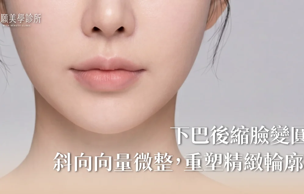 新願美學診所（郭毅昕醫師｜台北醫美推薦｜埋線鼻雕 |台北海芙音波媚必提｜海芙電波｜海菲秀｜探索皮秒｜喬雅登｜熊貓針推薦）